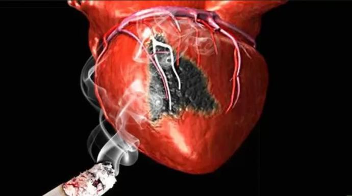 تقرير طبي: النيكوتين يشكل خطرًا مباشرًا على القلب والسجائر الإلكترونية كارثة