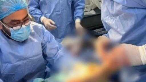 مستشفى مغاغة العام: يوم حافل بالإنجازات.. نجاح ٦ جراحات دقيقة ومتنوعة لإنهاء معاناة المرضى